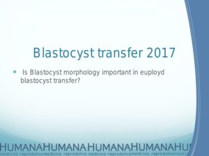 Blastocyst-Transfer-2017-15