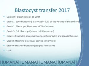 Blastocyst-Transfer-2017-3