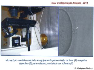 Laser-em-Reprodução-Assistida-2014-12