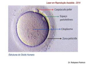 Laser-em-Reprodução-Assistida-2014-3
